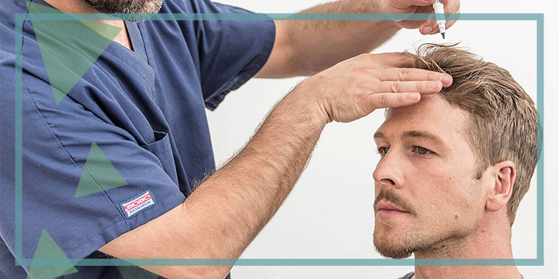 What You Need To Consider After Hair Transplantation