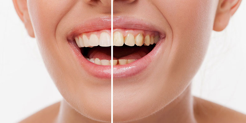 Ästhetische und restaurative Zahnbehandlungen